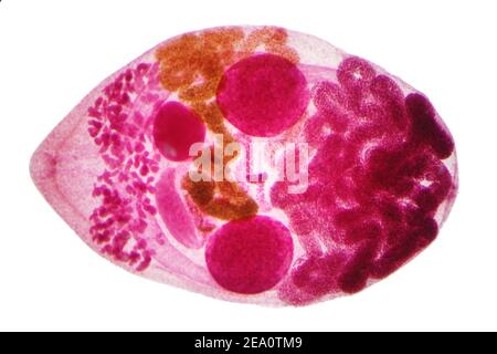 LIVER fluke, micrografia leggera Foto Stock