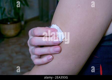 dopo l'iniezione nel muscolo della mano, la donna tiene un bastoncino di cotone Foto Stock
