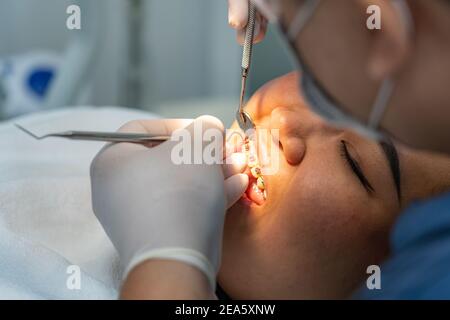 Primo piano foto di paziente femminile che indossa denti rinforzi avendo controllo dentale Foto Stock