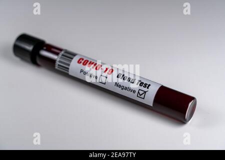 Provetta per campioni di sangue COVID-19 negativa. Primo piano isolato su sfondo bianco. Corona virus Foto Stock