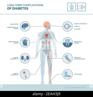 Complicazioni a lungo termine del diabete infografica medica: Diabete effetti sul corpo Illustrazione Vettoriale