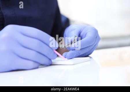 Il dentista tiene le bretelle nelle mani prima di installarle. L'applicazione della composizione adesiva. Allineamento della dentizione o del morso. Il concetto di salute. Foto Stock