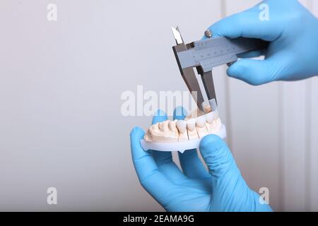 Un tecnico odontoiatrico effettua la misurazione delle impiallacciature. Inserti in ceramica e composito. Mani in guanti protettivi. Il concetto di bellezza e salute. Persona irriconoscibile. Foto Stock