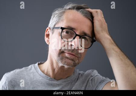 Balding uomo perdere capelli Foto Stock