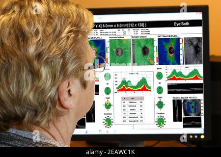 Specialista degli occhi femminile, (posato dal modello), che guarda le scansioni da un test degli occhi sullo schermo di un computer Foto Stock