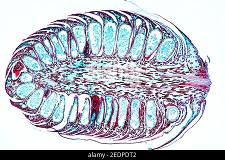 Pino (Pinus spec.), sezione longitudinale di un fiore/cono maschio di un pino, sezione microtomo Foto Stock