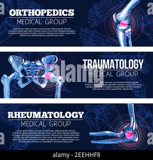 Set di striscioni medici per ortopedia, traumatologia e reumatologia. Disegno vettoriale di ossa radiografiche e articolazioni delle gambe del corpo umano ginocchio o piede, colonna vertebrale e braccio Illustrazione Vettoriale