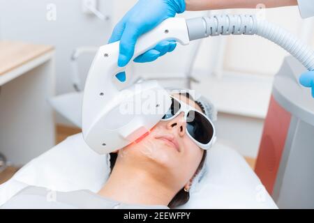 La procedura di ringiovanimento facciale ELOS di una ragazza attraente primo piano. Foto Stock
