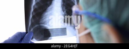 Pulmonologo in occhiali e maschera guarda ai raggi X dei polmoni in clinica Foto Stock