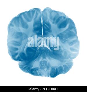 Sezione trasversale della corteccia cerebrale su sfondo bianco Foto Stock