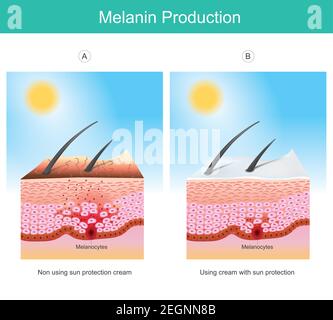 Produzione di melanina. Illustrazione che mostra colore pelle umana influenza da raggi UV la causa di stimolazioni cellule melanocitarie negli strati della pelle. Illustrazione Vettoriale