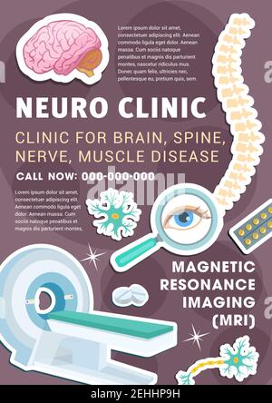 Poster pubblicitario clinica di neurologia della diagnosi e del trattamento delle malattie del sistema nervoso. Banner della tecnologia di diagnostica MRI con cervello, cellula neuronale, Illustrazione Vettoriale