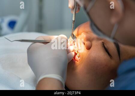 Primo piano foto di paziente femminile che indossa denti rinforzi avendo controllo dentale Foto Stock