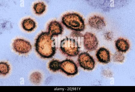 SARS-COV-2. Microscopio elettronico a trasmissione Foto Stock
