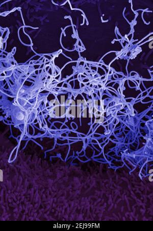 Virus Ebola da campione di sangue mali Foto Stock