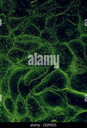 Virus Ebola da campione di sangue mali Foto Stock