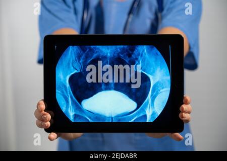 Medico femminile che tiene uno schermo con raggi X vescica. Foto Stock