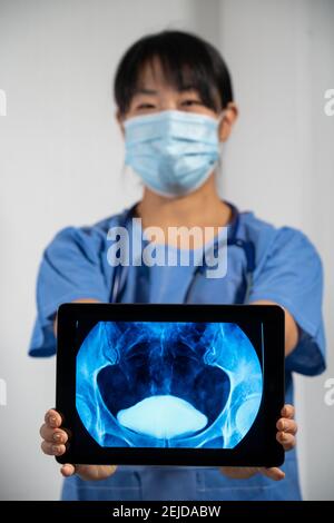 Medico femminile che tiene uno schermo con raggi X vescica. Foto Stock