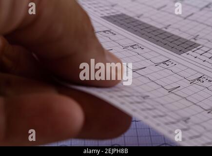 Mani di un uomo che tiene un elettrocardiogramma nell'ufficio del medico. Studio dell'elettricità del cuore. Rappresentazione dei battiti cardiaci su carta grafica Foto Stock