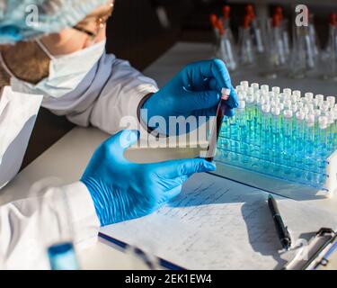 Laboratorio moderno - il medico tiene una provetta con sangue contaminato. Concetto di ricerca per la prevenzione delle infezioni da virus. Foto Stock