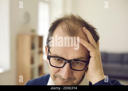 Balding uomo medio invecchiato preoccupato per la perdita di capelli tocca calvo macchie sulla testa Foto Stock