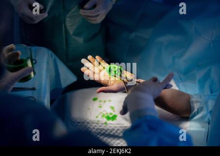 Uno dei due chirurghi professionisti in tute e guanti protettivi strofinare la mano del paziente con un pezzo di bendaggio verde prima funzionamento Foto Stock