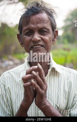 Nellore, Andhra Pradesh, India: Uomo con lebbra residente in un centro di riabilitazione nella rurale India. Foto Stock