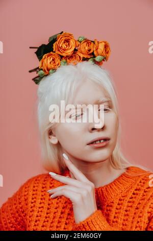 Immagine di stile di vita di una ragazza albina in posa in studio. Concetto di positività del corpo, diversità e moda Foto Stock