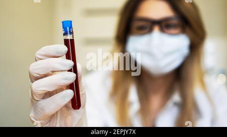 Una scienziata femminile che contiene una provetta con un campione di sangue. Il concetto di analisi e diagnostica di virus e malattie. Mettere a fuoco la provetta Foto Stock