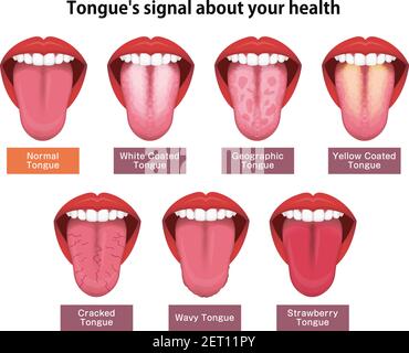 Insieme di illustrazioni vettoriali dei segni di salute di Tongue Illustrazione Vettoriale