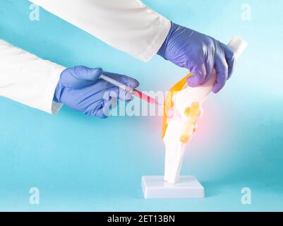Il medico inietta il plasma sanguigno del paziente nell'articolazione del ginocchio per ridurre il gonfiore e il dolore al ginocchio. Concetto di trattamento delle articolazioni del ginocchio con plasmotil Foto Stock
