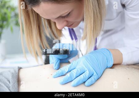 Il medico della donna esamina il segno di nascita di un paziente attraverso la lente di ingrandimento Foto Stock