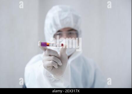 Ricercatore umano in DPI medici che mostra una provetta per l'analisi del sangue positiva Di Covid-19 in laboratorio Foto Stock