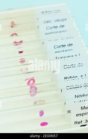 Vetrini con campioni di tessuto in un laboratorio medico. Paesi Baschi, Spagna, Europa. Foto Stock