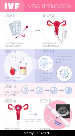 Fertilizzazione in vitro piatta colorata infografica IVF con passaggi per illustrazione del vettore di avanzamento della gravidanza Illustrazione Vettoriale