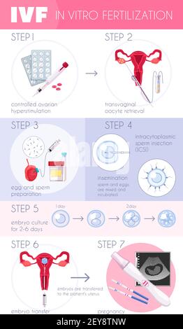 Fertilizzazione in vitro piatta colorata infografica IVF con passaggi per illustrazione del vettore di avanzamento della gravidanza Illustrazione Vettoriale