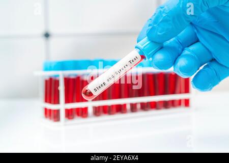 Analisi del sangue da stress e sonno, immagine concettuale Foto Stock