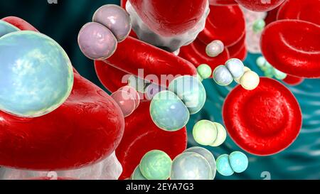 Meningococcemia, illustrazione Foto Stock