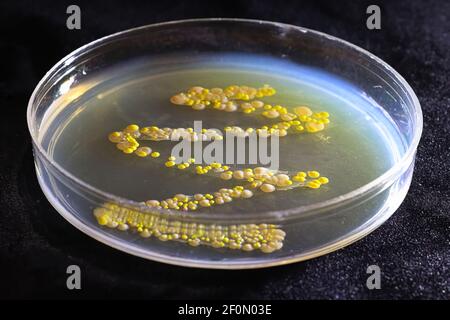 Una capsula di Petri con colonie comuni di lievito e batteri Foto Stock