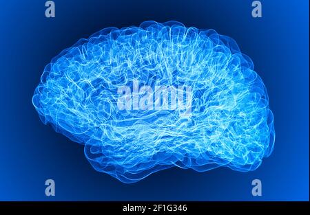 Dolore alla testa, al cervello e alle sinapsi, problemi cognitivi, deficit mentale. Aneurisma. Malattie degenerative che interessano l'area del cervello. Parkinson, ictus Foto Stock