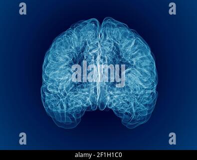 Dolore alla testa, al cervello e alle sinapsi, problemi cognitivi, deficit mentale. Aneurisma. Malattie degenerative che interessano l'area del cervello. Parkinson, ictus Foto Stock