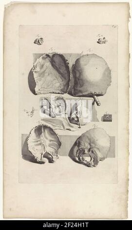 Studio anatomico della parte posteriore di un cranio e di altre parti. In alto a destra con il numero T. 90. Foto Stock