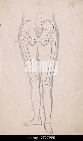 Pelvi umano con una rottura nell'osso .. Foto Stock