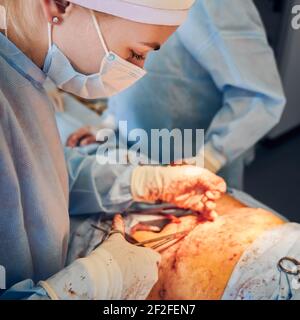 Medico femminile che fa la chirurgia di abdominoplastica in clinica. Foto Stock