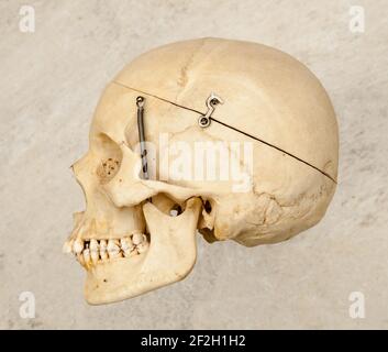 Vista laterale o del profilo di un cranio umano preparato per studi medici. Foto Stock