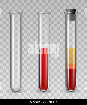 Provette per analisi con sangue. Provetta medica in vetro realistica vuota, riempita con globuli rossi, plasma ricco di piastrine. Set di vettori per la terapia dermatologica PRP Illustrazione Vettoriale