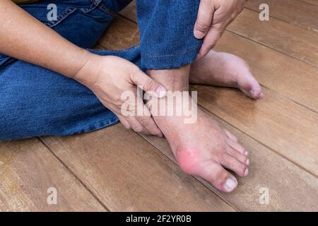 Mano abbracciando piede infiammato con gotta dolorosa su pavimento di legno Foto Stock