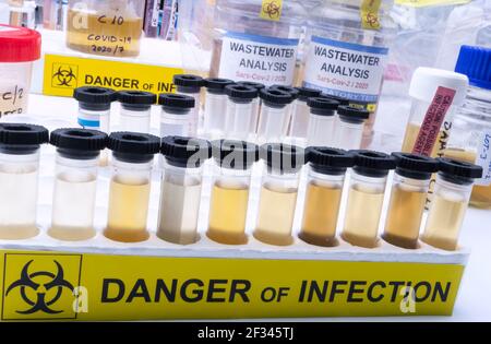 Analisi del virus sars-COV-2 nell'uomo in un laboratorio di acque reflue, immagine concettuale Foto Stock