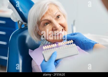 Tinta dentale professionale abbinata con denti in pensione Foto Stock