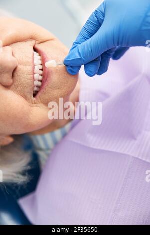 Dentista che trova una corrispondenza ai denti dell'ospite con l'ombra del dente Foto Stock